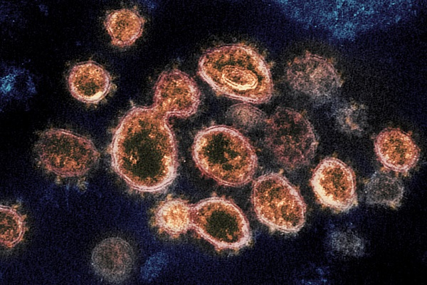 Coronavirus, OMS ufficializza: ora è pandemia globale